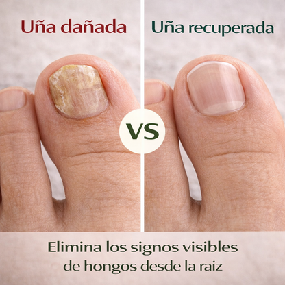 CleanNails®- Parches Anti Hongos Pack 2x1.